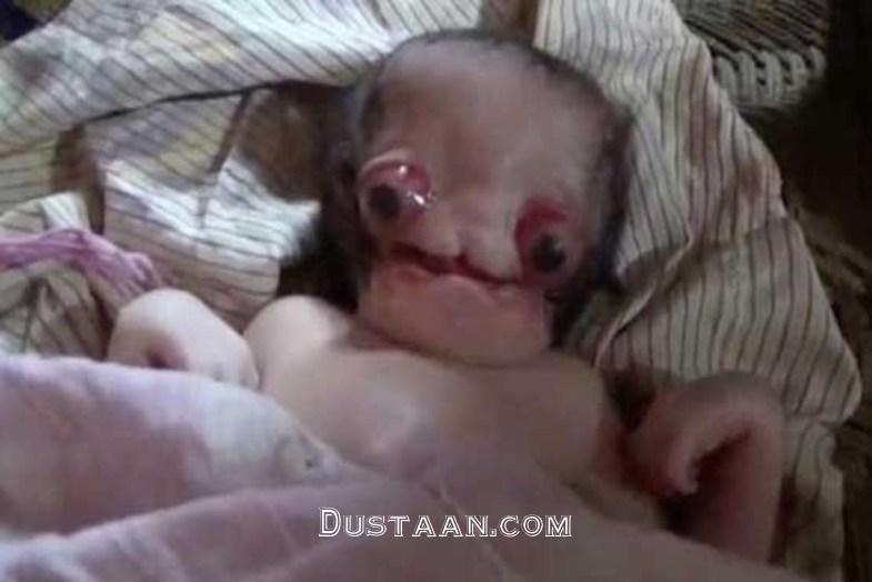 www.dustaan.com تولد نوزاد فضایی در هند +تصاویر