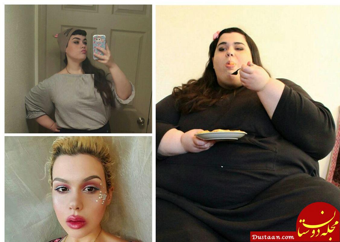 www.dustaan.com چهره متفاوت دختر جوان پس از 180 کیلو لاغری! +عکس