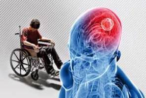 با دلایل و علایم بیماری ام اس اشنا شوید