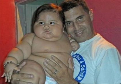 کودک 8 ماهه کلمبیایی با وزن 21 کیلوگرم! +تصاویر