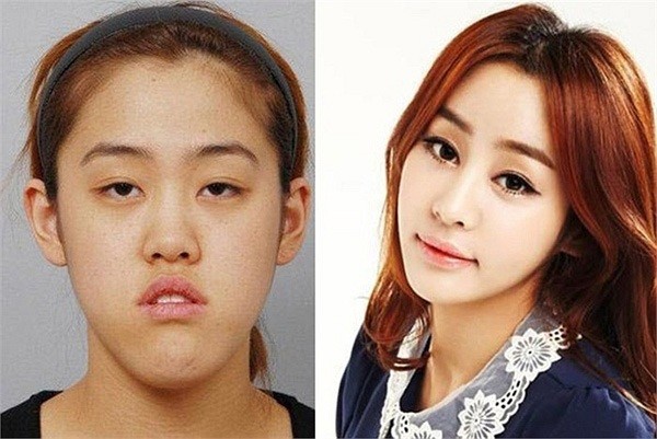 عدم شناسایی دختران کره‌ای بعد از جراحی زیبایی! +تصاویر
