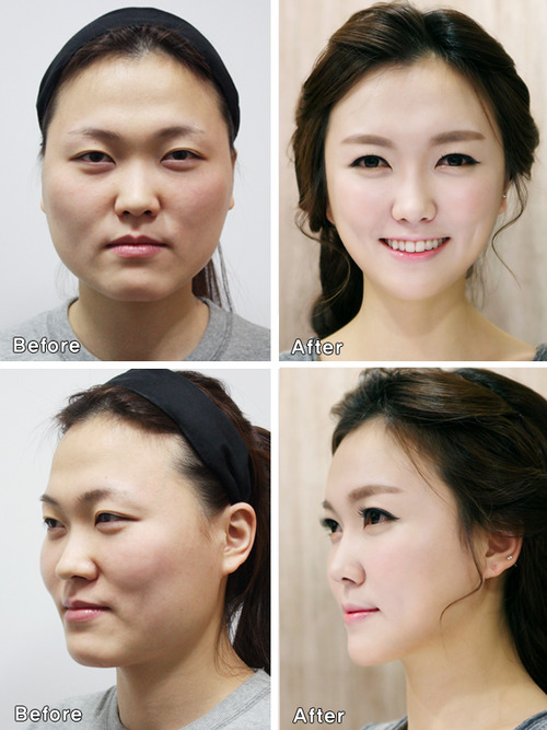 عدم شناسایی دختران کره‌ای بعد از جراحی زیبایی! +تصاویر