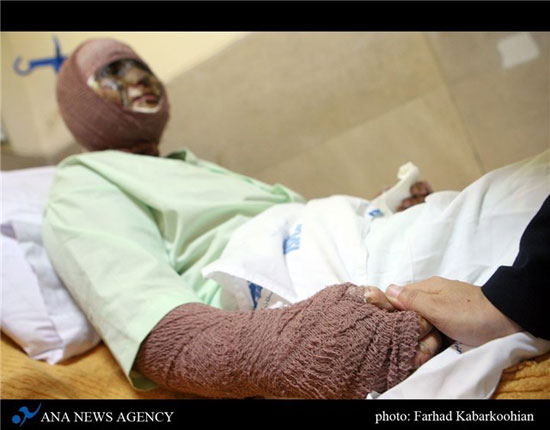 www.dustaan.com-اسید پاشی زیبایی «سیما» را تباه کرد4