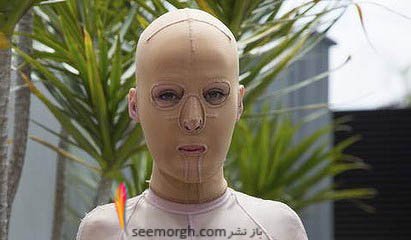 www.dustaan.com-چهره جراحی شده زن هالیوودی بعد از اسید پاشی1