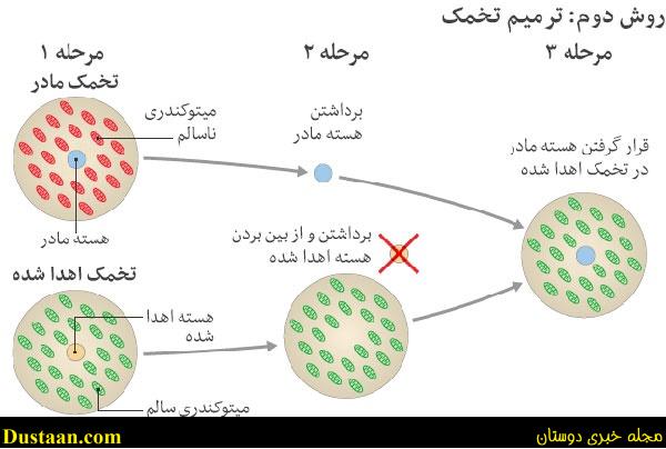 تولد نخستین نوزاد جهان با 
