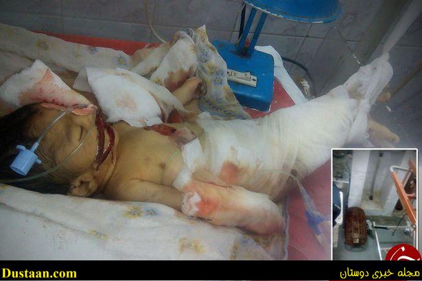 نوزاد نارس توسط موش ها زنده زنده خورده شد+‌عکس