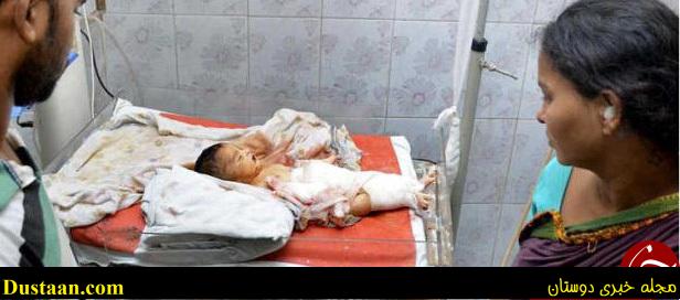 نوزاد نارس توسط موش ها زنده زنده خورده شد+‌عکس