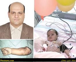 پیوند دست قطع‌شده کودک 