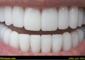 www.dustaan.com-چگونه دندان هایی چون مروارید داشته باشیم؟