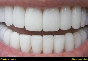 www.dustaan.com-چگونه دندان هایی چون مروارید داشته باشیم؟