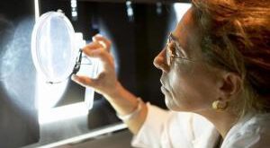 علائم کبد سمی