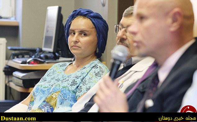 پیوند صورت زندگی را به این زن بازگرداند +تصاویر