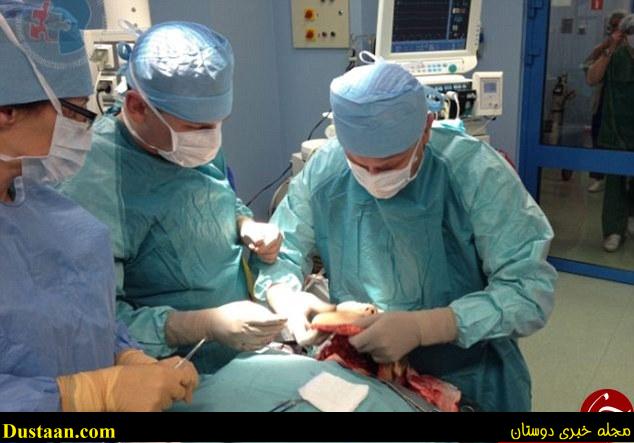 پیوند صورت زندگی را به این زن بازگرداند +تصاویر