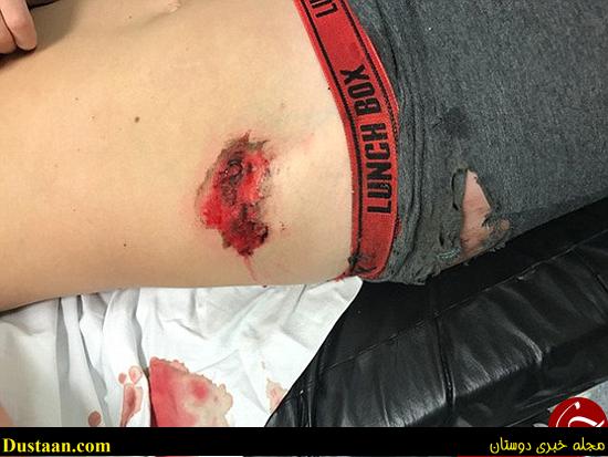 اتوبوس این پسر را روی زمین کشید +تصاویر