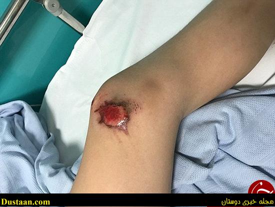 اتوبوس این پسر را روی زمین کشید +تصاویر