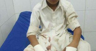 حمله میمون های مهاجم به پنج نفر در سراوان