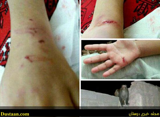 حمله میمون های مهاجم به پنج نفر در سراوان حمله میمون های مهاجم به پنج نفر در سراوان