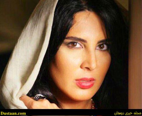 عکس لیلا بلوکات قبل از جراحی بینی