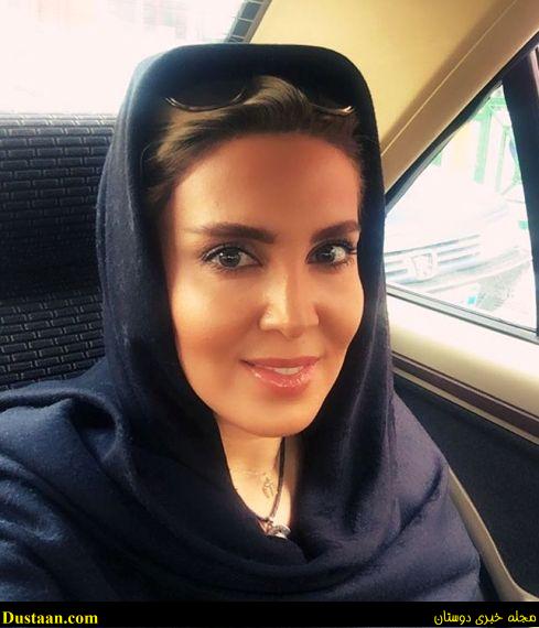 عکس لیلا بلوکات پس از جراحی بینی