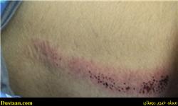 جزئیات ضرب و شتم دانش‌آموز تبریزی توسط معلم +تصاویر