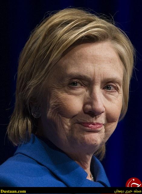 تفاوت آشکار چهره هیلاری کلینتون قبل و پس از انتخابات +تصاویر