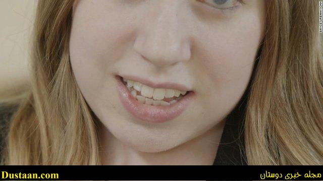 دختری که درحال سنگ شدن است