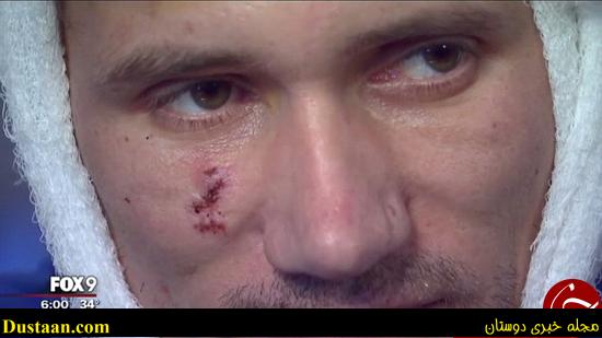 اخبارگوناگون,خبرهای گوناگون,ماجرای عجیب میخ