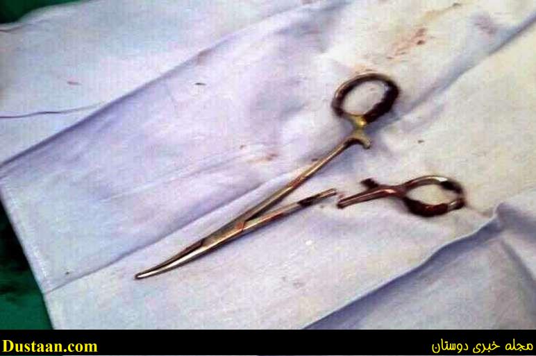 www.dustaan.com-عکس: قیچی جراحی بعد از ۱۸ سال از شکم بیمار خارج شد!