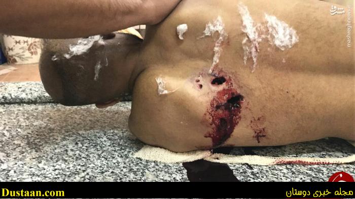 تصویری از پیکر شهید بحرینی در غسالخانه 18+ تصویری از پیکر شهید بحرینی در غسالخانه 18+