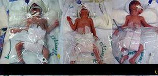 تولد ۵ قلوها