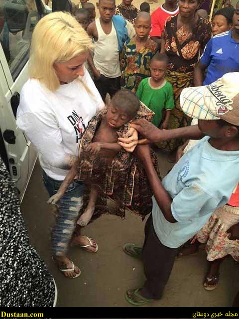 اخباراجتماعی,خبرهای اجتماعی ,فرجام کودکی که عکسش جهان را تکان داد اخباراجتماعی,خبرهای اجتماعی ,فرجام کودکی که عکسش جهان را تکان داد