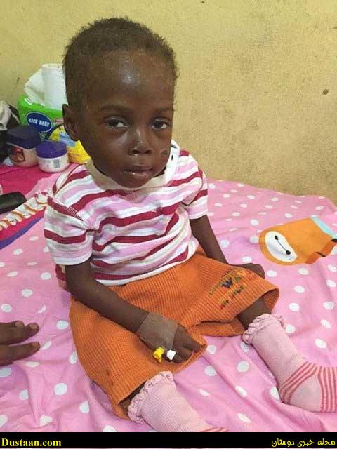 اخباراجتماعی,خبرهای اجتماعی ,فرجام کودکی که عکسش جهان را تکان داد اخباراجتماعی,خبرهای اجتماعی ,فرجام کودکی که عکسش جهان را تکان داد