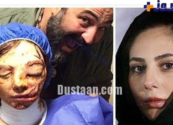 چهره وحشتناک بازیگر زن ایرانی
