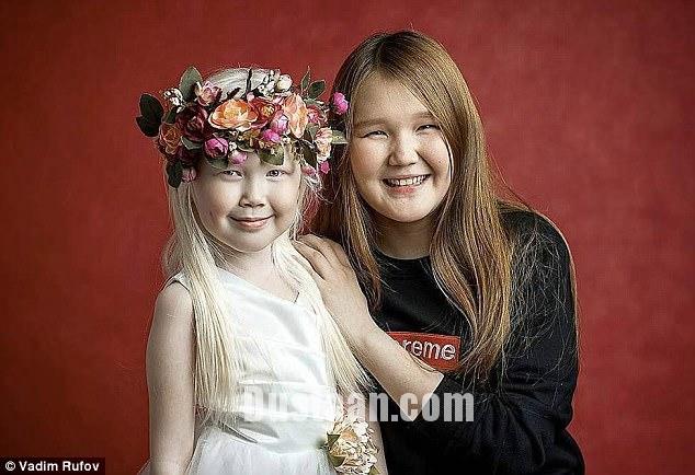 The Siberian 'Snow White' is seen with her sister Karina, 14, who has dark hair and features