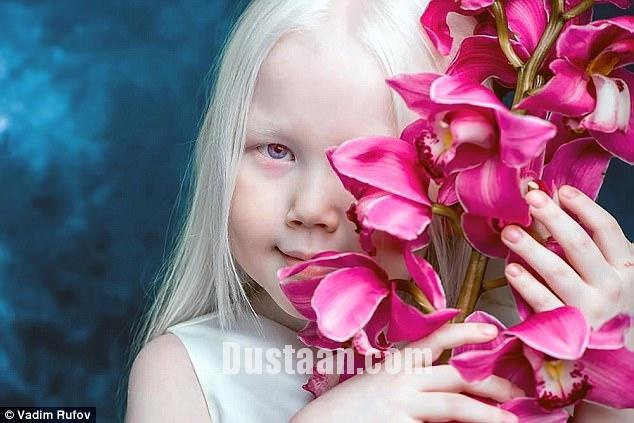 The eight-year-old albino has already had offers from modelling and advertising agencies 