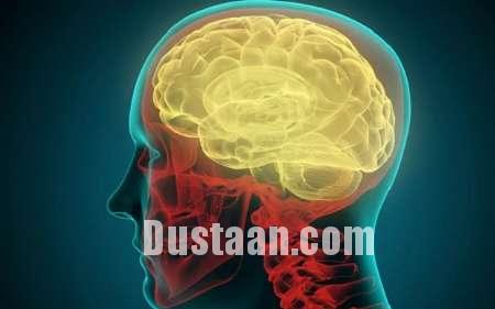 اخبار پزشکی,خبرهای  پزشکی, بیماری ام اس