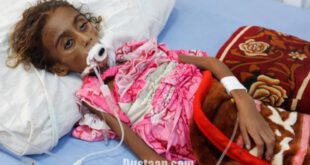 مرگ دختر یمنی بر اثر سوءتغذیه