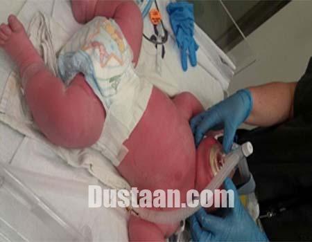 تولد نوزاد هفت کیلویی