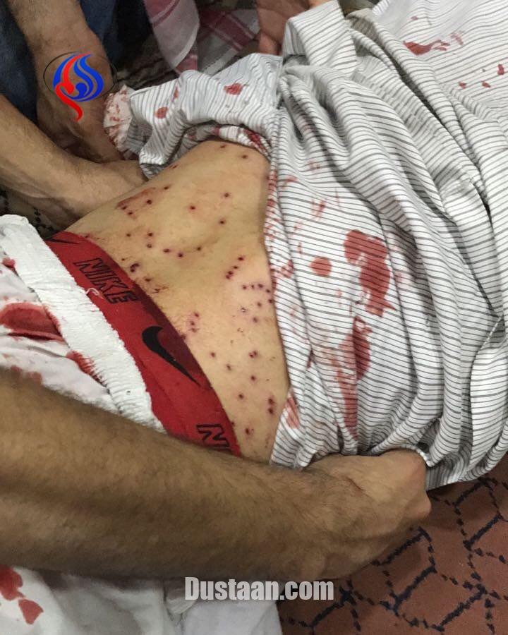 www.dustaan.com-حمله نظامیان آل‌ خلیفه به تحصن کنندگان بحرینی +تصاویر