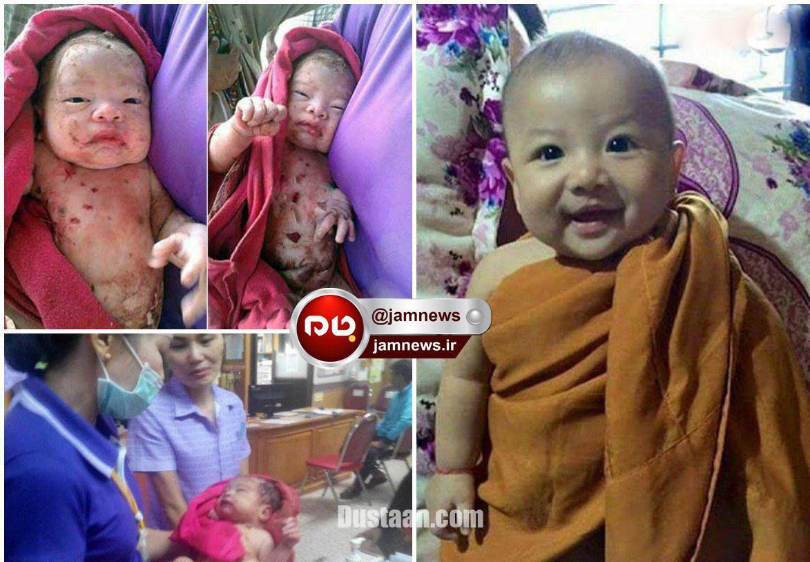 نوزادی که ۱۴ضربه چاقو خورد اما زنده ماند