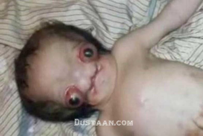 تولد نوزاد فضایی در هند +تصاویر www.dustaan.com تولد نوزاد فضایی در هند +تصاویر