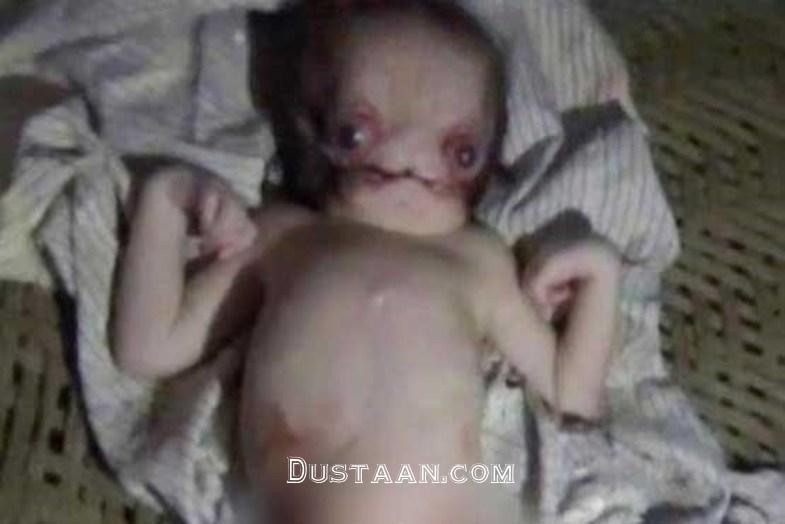 تولد نوزاد فضایی در هند +تصاویر www.dustaan.com تولد نوزاد فضایی در هند +تصاویر