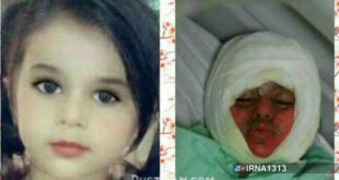 سقوط کودک سه ساله در دیگ خورش نذری