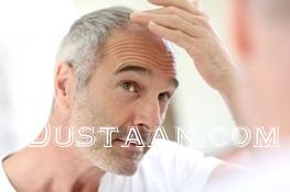 www.dustaan.com-راهکار جدید پزشکان برای جلوگیری از ریزش مو در شیمی درمانی