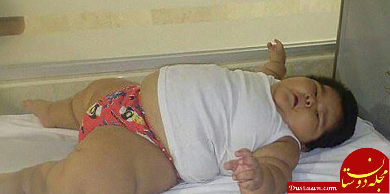چاق ترین کودک ۱۰ ماهه جهان با ۳۰ کیلوگرم وزن+ تصاویر
