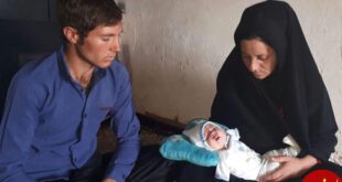 تولد نوزاد بدون دست؛ قصور پزشکی یا محرومیت