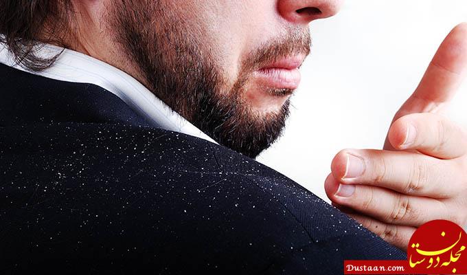 https://www.mapleholistics.com/wp-content/uploads/2015/09/What-are-essential-oils-for-dandruff.jpg