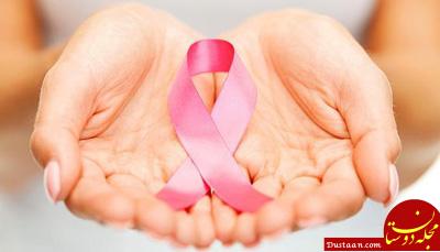 سرطان های زنانه,سرطان سینه