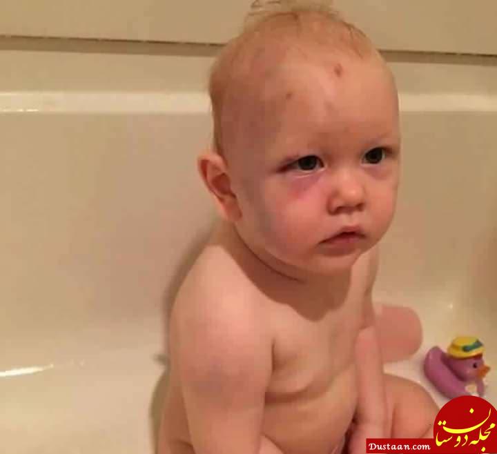 تصویری تکان دهنده از یک نوزاد شبکه های اجتماعی را به آتش کشید!