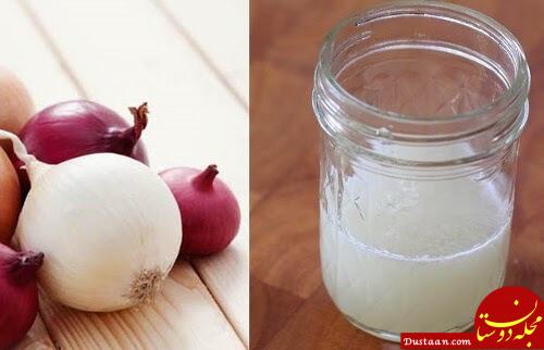 https://steptohealth.com/wp-content/uploads/2015/06/Onion-juice-for-your-hair.jpg